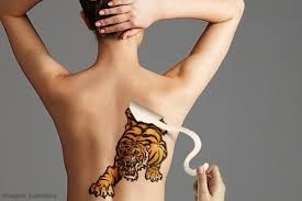 Orçamento para Remover Tatuagens em São Caetano do Sul - Remoção de Tattoo
