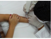 orçamento para clínica de remoção de tatuagem em São Caetano do Sul