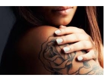remoção de tatuagem definitiva preço em São Caetano do Sul