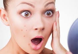 Tratamento Facial para Acne em Santo André - Tratamento Facial para Acne