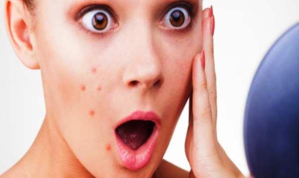 Tratamentos Faciais para Acne em Santo André - Tratamento Facial para Espinhas